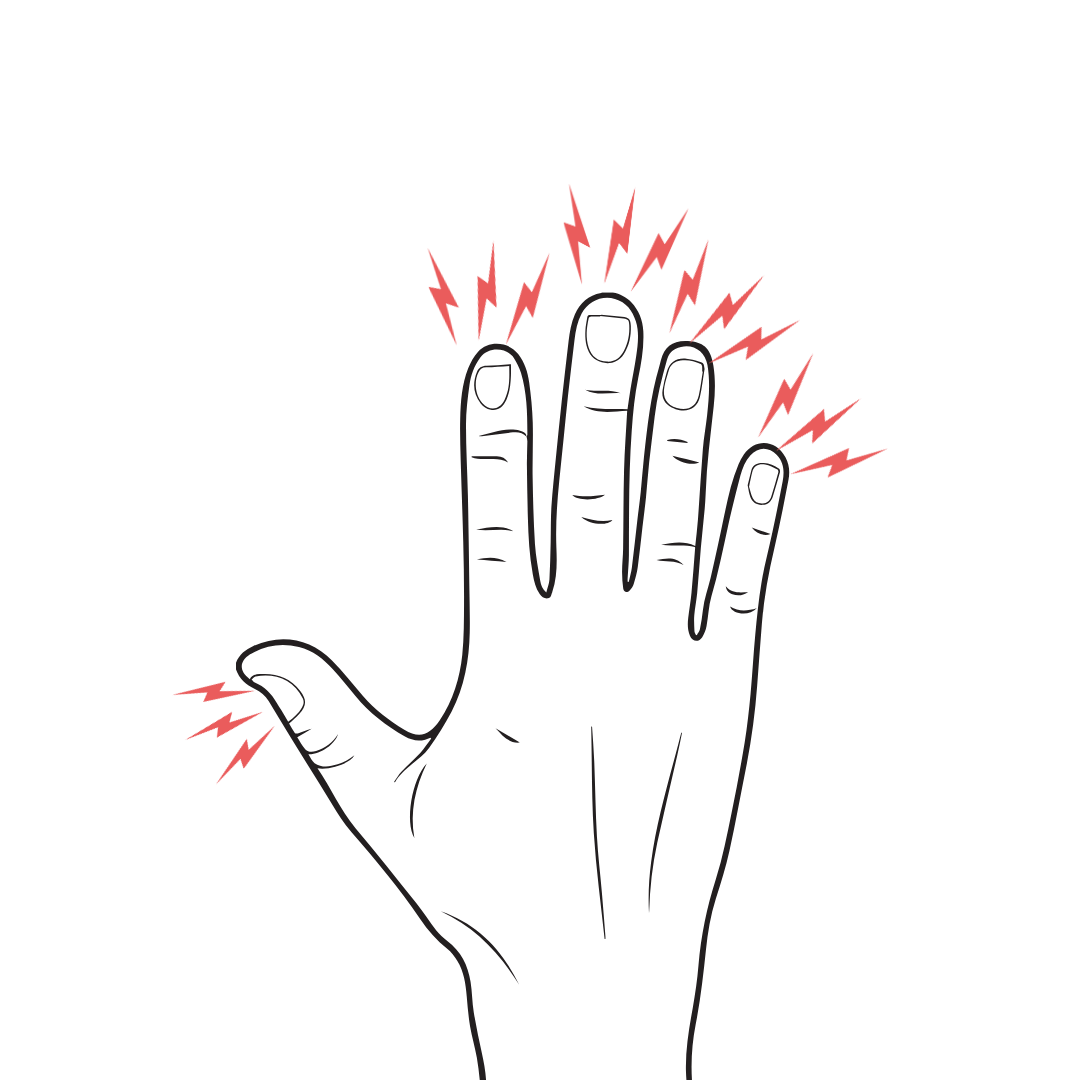 Swelling of the Nail Beds Guide to POTS